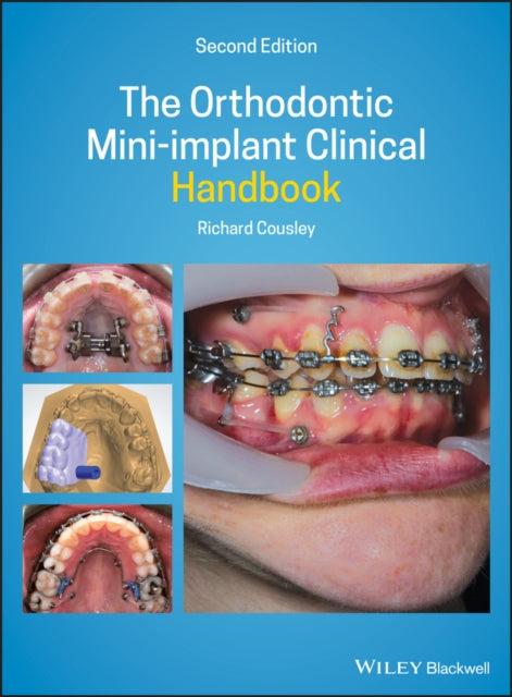 The Orthodontic Mini–implant Clinical Handbook 2nd Edition