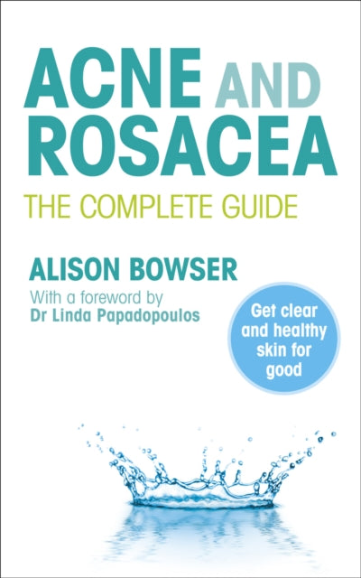 Acne and Rosacea : The Complete Guide-9780091929701