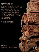 Ortner's Identification of Pathological Conditions in Human Skeletal Remains-9780128097380