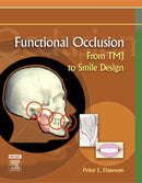 Functional Occlusion : From TMJ to Smile Design-9780323033718