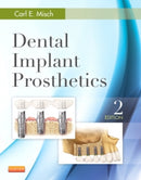 Dental Implant Prosthetics-9780323078450