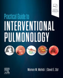 Practical Guide to Interventional Pulmonology-9780323709545