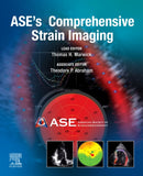 ASE's Comprehensive Strain Imaging-9780323759472