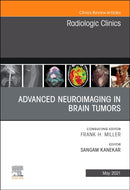 Advanced Neuroimaging in Brain Tumors, An Issue of Radiologic Clinics of North America : Volume 59-3-9780323794213