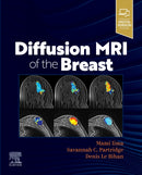 Diffusion MRI of the Breast-9780323797023