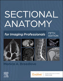 Sectional Anatomy for Imaging Professionals-9780323827881