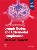 Diagnostic Pathology: Lymph Nodes and Extranodal Lymphomas-9780323847582