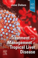 Treatment and Management of Tropical Liver Disease-9780323870313