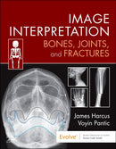 Image Interpretation: Bones, Joints, and Fractures-9780323870801