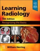 Learning Radiology : Recognizing the Basics-9780323878173