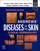 Andrews'' Diseases of the Skin