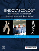 Endovascology : Endovascular Treatment of Vascular Systematic Pathologies-9780323899277