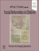 Facial Deformities in Children : Thirteen Life Changing Operations-9780323932394