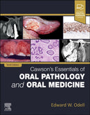 Cawson's Essentials of Oral Pathology and Oral Medicine-9780323935494