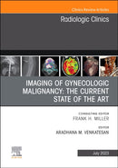Imaging of Gynecologic Malignancy: The Current State of the Art, An Issue of Radiologic Clinics of North America : Volume 61-4-9780323940351