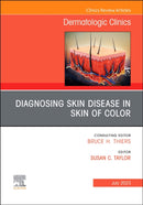 Diagnosing Skin Disease in Skin of Color, An Issue of Dermatologic Clinics