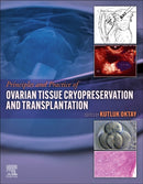 Principles and Practice of Ovarian Tissue Cryopreservation and Transplantation-9780323957533