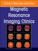 MR Imaging of the Adnexa, An Issue of Magnetic Resonance Imaging Clinics of North America : Volume 31-1-9780323987677
