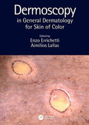 Dermoscopy in General Dermatology for Skin of Color-9780367418403