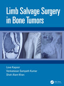 Limb Salvage Surgery in Bone Tumors-9780367421304