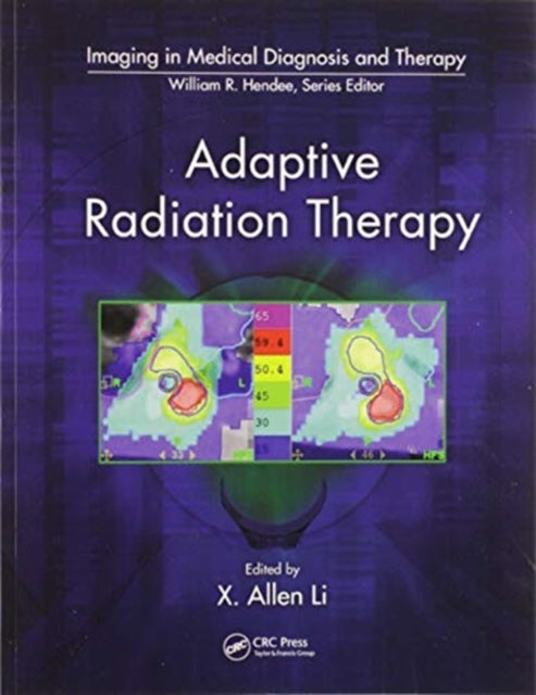 Adaptive Radiation Therapy-9780367577001