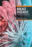 Breast Diseases : Guidelines for Management-9780367609696