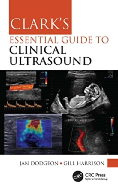 Clark''s Essential Guide to Clinical Ultrasound