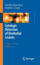 Cytologic Detection of Urothelial Lesions-9780387239453