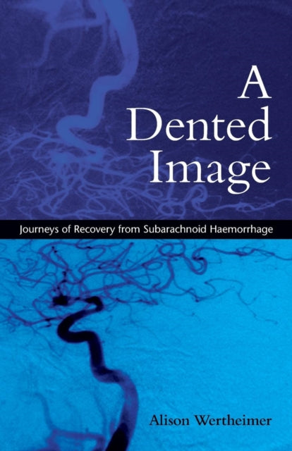A Dented Image : Journeys of Recovery from Subarachnoid Haemorrhage-9780415386722