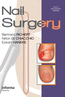 Nail Surgery-9780415472333