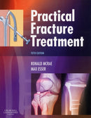 Practical Fracture Treatment-9780443068768