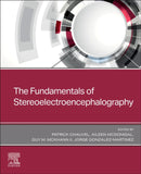 The Fundamentals of Stereoelectroencephalography-9780443108778