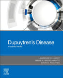 Dupuytren's Disease : A Scientific Review-9780443114878