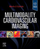 Multimodality Cardiovascular Imaging-9780443115141