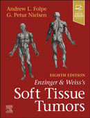 Enzinger and Weiss's Soft Tissue Tumors