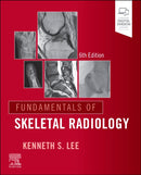 Fundamentals of Skeletal Radiology-9780443264542