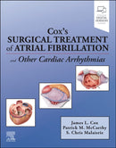 Cox''s Surgical Treatment of Atrial Fibrillation
