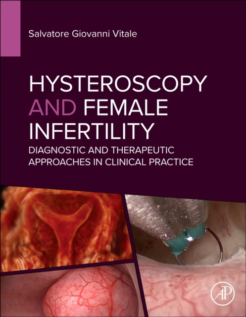 Hysteroscopy and Female Infertility