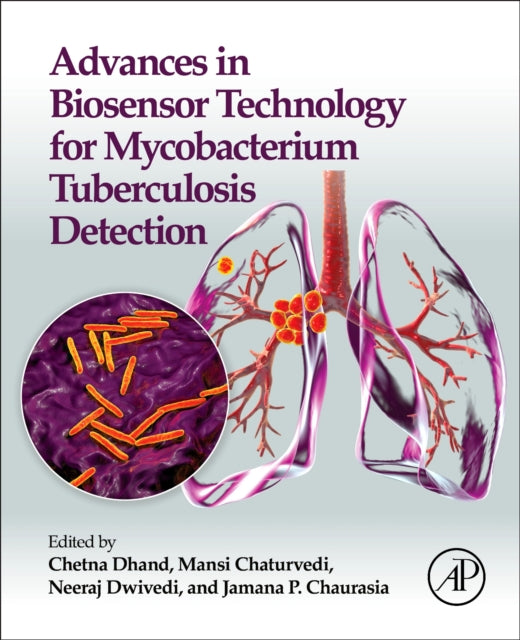 Advances in Biosensor Technology for Mycobacterium Tuberculosis Detection