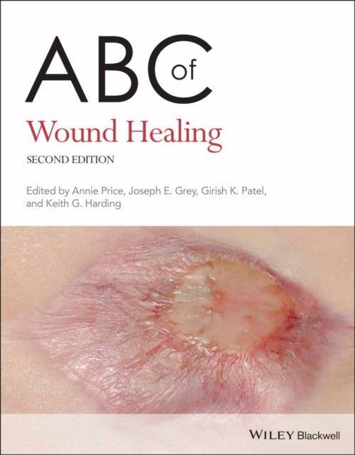 ABC of Wound Healing-9780470658970