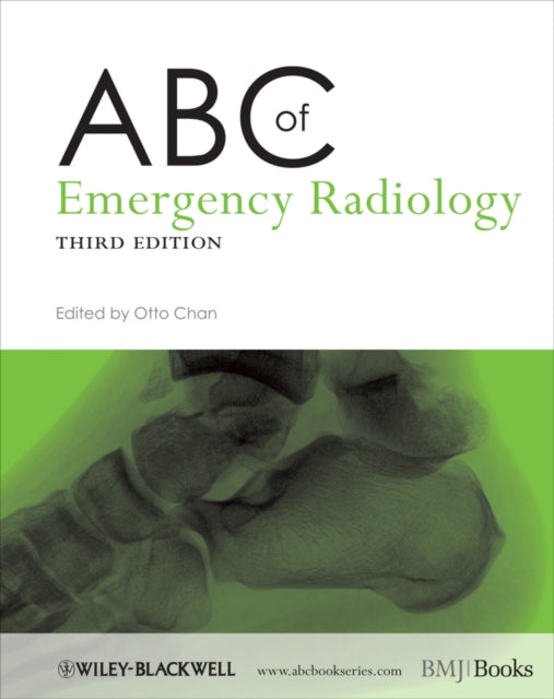 ABC of Emergency Radiology-9780470670934