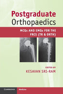 Postgraduate Orthopaedics : MCQs and EMQs for the FRCS (Tr & Orth)-9780521184717