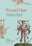 Wound Man – The Many Lives of a Surgical Image