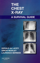 The Chest X-Ray: A Survival Guide-9780702030468