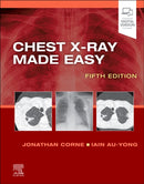Chest X-Ray Made Easy-9780702082344