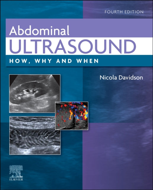 Abdominal Ultrasound : How, Why and When-9780702082436
