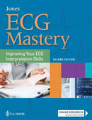ECG Mastery : Improving Your ECG Interpretation Skills-9780803676930