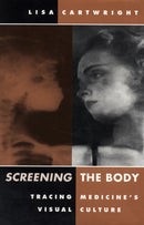 Screening the Body : Tracing Medicine's Visual Culture-9780816622900