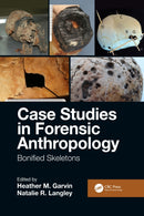Case Studies in Forensic Anthropology : Bonified Skeletons-9781032086569