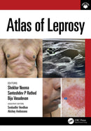 Atlas of Leprosy-9781032209234
